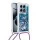 thumbnail image 1 of Funda FOXDOCK para Xiaomi 14T con Cuerda Ajustable, Brillo Líquido, Protección Antigolpes y Lente – Ideal para Regalo, 1 of 6