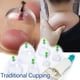 thumbnail image 2 of Traditional Cupping Vacuum Massager Professional Suction Cup Vacuum Massage Jar Physiotherapy Guasha Therapy Set Beauty Health, 2 of 3