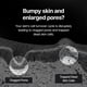 thumbnail image 5 of Crema Skin Booster MEDITHERAPY con retinal, ligera, 100 ml, 5 of 9