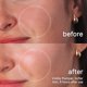 thumbnail image 5 of Suero Facial burnd Restaurador del Microbioma y Reparador de la Barrera 30 mL, 5 of 9