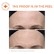thumbnail image 4 of Peel Dr. Dennis Gross Alpha Beta Ultra Gentle a diario (5 tratamientos), 4 of 6