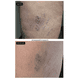 thumbnail image 4 of Spray Frio Muscular 100ml, 4 of 7