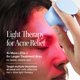 thumbnail image 3 of Dispositivo de Terapia de Luz Solawave Bye Acne con LED Azul y Rojo, 3 of 9