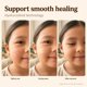 thumbnail image 4 of Apósitos hidrocoloides Kissprinkle MoistureBand 35 piezas para niños, 4 of 9