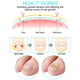 thumbnail image 3 of Corrector de Uña Encarnada JLHealth, 60 Piezas, Parche No Tejido, 3 of 3