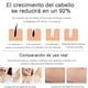 thumbnail image 3 of Depiladora Laser Ipl A Luz, 3 of 7