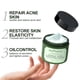 thumbnail image 3 of JoyPretty Herbal Acne Face Cream Body Pimple Treatment Oil Control Moisturizing Facial Creams Skin Care Products Beauty, 3 of 3