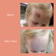 thumbnail image 3 of Bálsamo para bebés TrueLipids Boo & Bum Balm, 50 ml, para dermatitis del pañal, 3 of 8