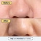 thumbnail image 4 of Minimizador de poros Remedy Science con retinol y ácido salicílico BHA, 4 of 8