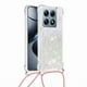 thumbnail image 1 of Funda FOXDOCK para Xiaomi 14T con Cuerda Ajustable, Brillo Líquido, Protección Antigolpes y Lente – Ideal para Regalo, 1 of 6