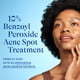thumbnail image 3 of Tratamiento localizado Differin Acne con peróxido de benzoilo al 10%, 30 ml, 3 of 9
