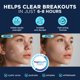 thumbnail image 4 of Parche hidrocoloide para acné Pimple Patches Duracleanse, 134 unidades, 4 of 6