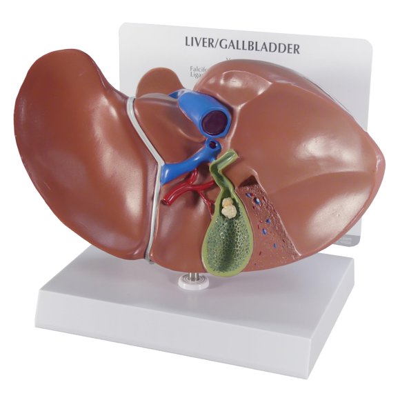 Modelo Anatómico de Hígado GPI Anatomicals 20 × 14 × 14 cm con Cálculos Biliares