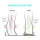 thumbnail image 3 of Plantillas Ortopédicas FootScientific Tipo 1 para Pies Planos Talla 6-6.5, 3 of 6