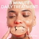 thumbnail image 5 of Dispositivo de Tratamiento para Labios Dr Dennis Gross DRx SpectraLite Pro, 5 of 8