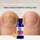 thumbnail image 3 of Tratamiento Antifúngico para Uñas Rejuvica Health 15 ml, 3 of 8