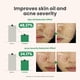 thumbnail image 5 of Tratamiento localizado AXIS-Y Spot The Difference 15 ml con 4-terpineol, 5 of 7