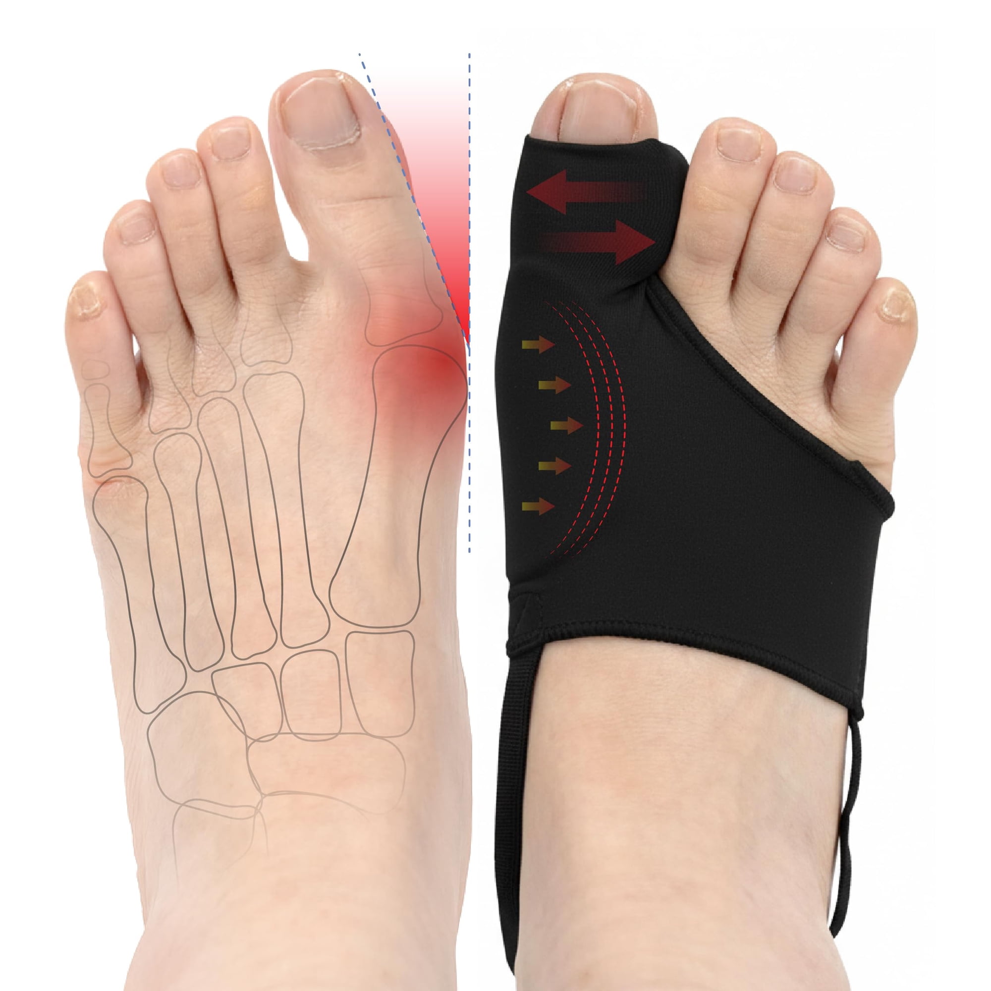 Corrector De Juanetes Dr Jk Para Mujeres Y Hombres, 2 Unidades, Negro