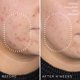 thumbnail image 5 of Sérum Medik8 Niacinamide Peptides 30 mL Piel visiblemente limpia, 5 of 9