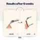 thumbnail image 2 of Herramienta para Fimosis GlanMax de Acero Inoxidable 24 mm, 2 of 6