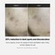 thumbnail image 3 of Sérum Medicube Deep Vita C 2.0 con un 14,5% de vitamina C pura, 30 ml x 3, 3 of 3