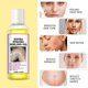 thumbnail image 2 of Aceite Exfoliante Extra Fuerte COGUREI 110 ml, 2 of 8