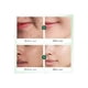 thumbnail image 2 of Serum Acido  Salicílico   Esencia Anti-Acné Control Y Reparacion   40ml, 2 of 3