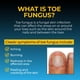 thumbnail image 4 of Spray antifúngico para pies Fungi-Nail de 30 ml con tolnaftato, 4 of 7