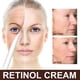 thumbnail image 2 of Rejuvenate Your Skin with 1pc Retinol Cream: Deeply Hydrating & Nourishing Face Moisturizer for Women with Vitamin C, 2 of 4