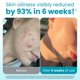 thumbnail image 2 of Toallas faciales Clean Skin Club Blemish Control XL, 50 unidades, 2 of 9