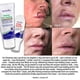 thumbnail image 3 of Gel TriDerma Scar Block Calmante Transparente 28 g, 3 of 5