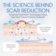 thumbnail image 5 of Parches para cicatrices ScarScience Advanced Medical Silicone, 12 tiras, 5 of 7