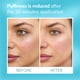thumbnail image 3 of Parche de terapia ocular Talika Instant Smoothing, 6 recambios, 3 of 8