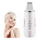 thumbnail image 1 of Paleta Ultrasonica Facial Limpiador Acne Limpiador 3-1, 1 of 3