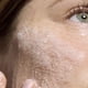 thumbnail image 4 of Limpiador facial m-61 120 ml Hipoalergénico sin fragancia, 4 of 6