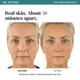 thumbnail image 4 of Mascarilla facial Dr. Sevinor 118 ml Exfoliante de ácido glicólico, 4 of 9