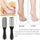 thumbnail image 4 of Juego de herramientas de pedicura 27 en 1 de acero inoxidable para el cuidado de los pies, lima para pies, removedor de piel muerta, exfoliante de pies, spa, removedor de callos, para hombres, mujeres, 4 of 8