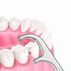thumbnail image 2 of Limpiador De Dientes De Acero Inoxidable, 2 of 3