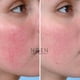 thumbnail image 2 of Crema para Pieles Delicadas - Antirojeces - Calmante e hidratante, 2 of 4