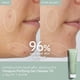 thumbnail image 2 of Gel Purificador De Poros Cleanser Vinopure 150 Ml, 2 of 2