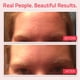 thumbnail image 4 of Sérum YEOUTH Retinol para rostro con ácido hialurónico 30 ml para toda la piel, 4 of 7