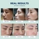 thumbnail image 4 of Parches antiarrugas PETITE PLUIE Face Lift con colágeno, 50 unidades, 4 of 6
