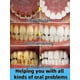 thumbnail image 2 of V34 Purple Teeth Whitening Toothpaste Remove Plaque Stains Cleaning Oral Hygiene Dental Tools Fresh Breath Beauty Health Care, 2 of 3