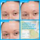 thumbnail image 4 of Almohadillas de tónico innisfree Daily Gentle Retinol para acné salicílico, 4 of 8