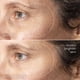 thumbnail image 3 of Serum Medik8 C-Tetra Advanced 30 ml con vitamina C y ácido hialurónico, 3 of 9