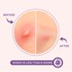 thumbnail image 4 of Pimple Patches KEYCONCEPTS Ácido salicílico con aceite de árbol de té 240, 4 of 6