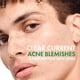 thumbnail image 2 of Gel Limpiador Facial Vichy Normaderm 400 ml Ácido Salicílico, 2 of 3