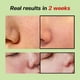 thumbnail image 5 of Ampolla Sungboon Editor Green Tomate, para mejorar los poros, 30 ml, 5 of 9