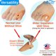 thumbnail image 2 of Corrector de Juanetes Chiroplax con Gel Protector para los Dedos, 2 of 7