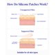 thumbnail image 4 of Parche Antiedad Wrinkles Schminkles 2 Unidades Reutilizables, 4 of 7